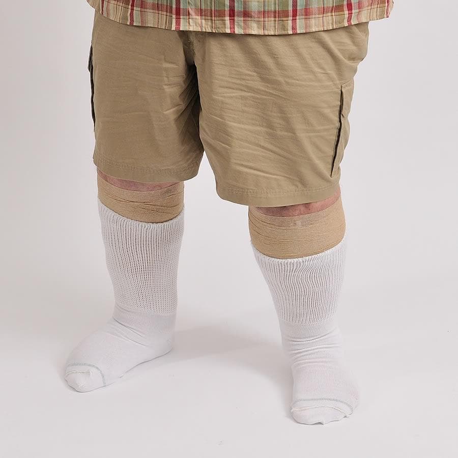 A person in shorts wearing white extra wide medical socks over bandages - The Socker