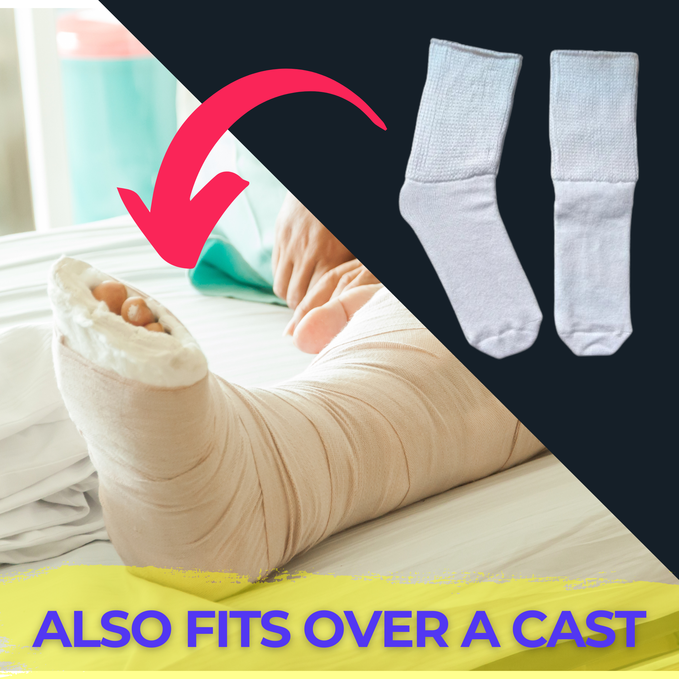 white extra wide sock for people wearing casts - The Sockery - The Sockery